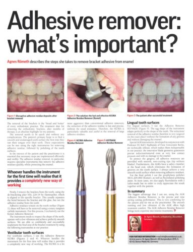 FB | Adhesive remover: what's important?