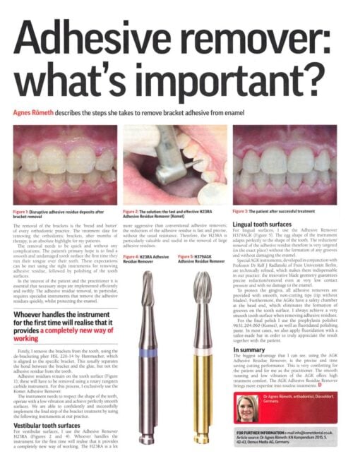 FB | Adhesive remover: what's important?