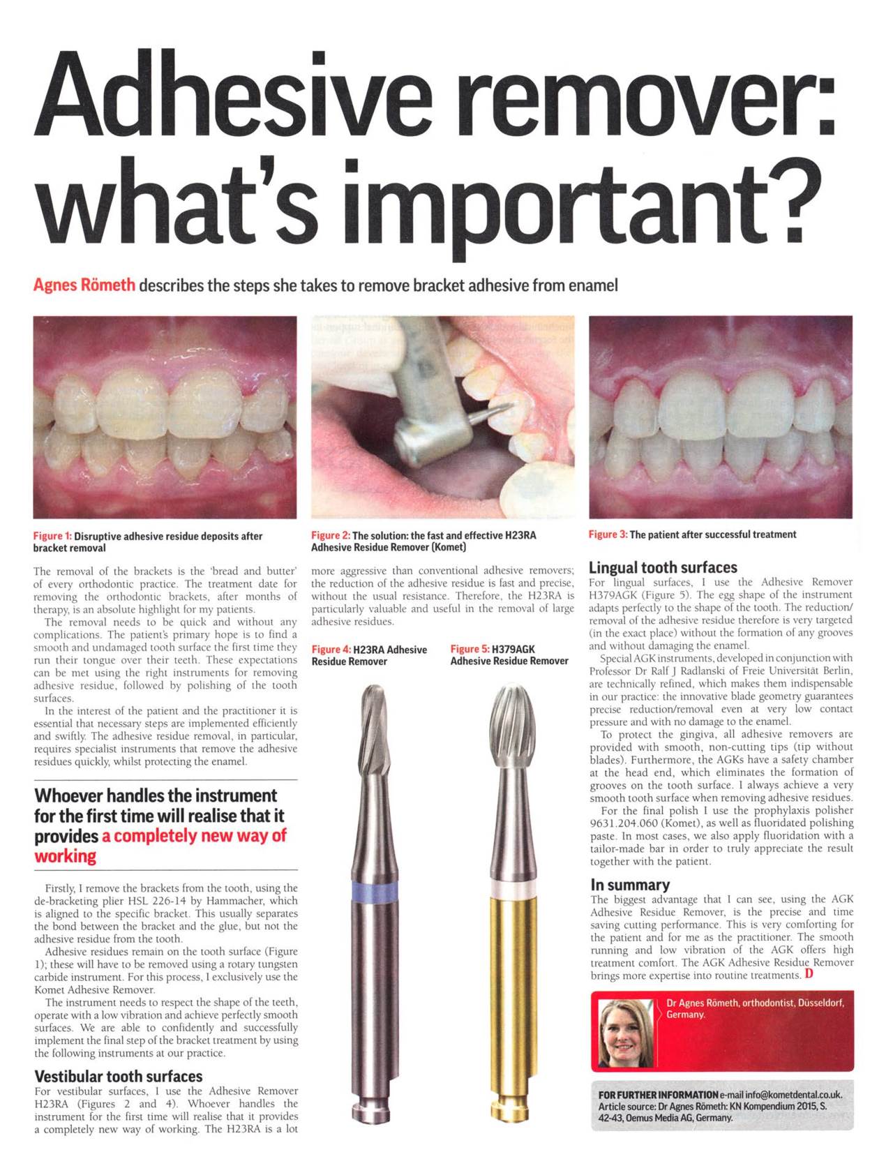 FB Adhesive remover what's important? › Komet Dental