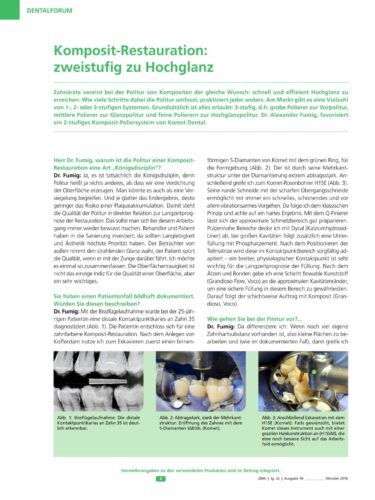 FB | Komposit-Restauration: zweistufig zu Hochglanz