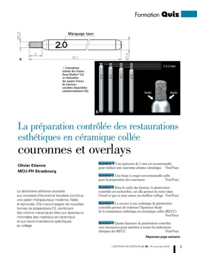 Revue de Presse | Quiz Préparation contrôlée des restaurations - Dr Etienne