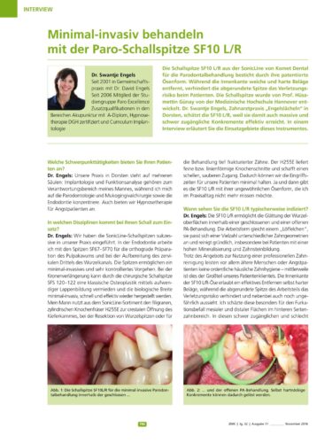 FB | Minimal-invasiv behandeln mit der Paro-Schallspitze SF10 L/R
