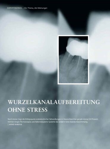 FB | Wurzelkanalaufbereitung ohne Stress