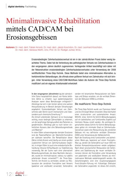 FB | Minimalinvasive Rehabilitation mittels CAD/CAM bei Erosionsgebissen