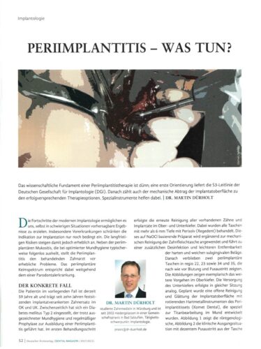 FB | Periimplantitis - Was tun?