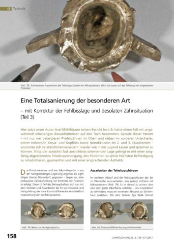 FB | Eine Totalsanierung der besonderen Art (Teil 3)