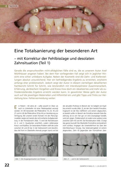FB | Eine Totalsanierung der besonderen Art (Teil 1-4)