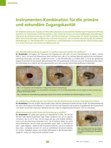FB | Instrumenten-Kombination für die primäre und sekundäre Zugangskavität