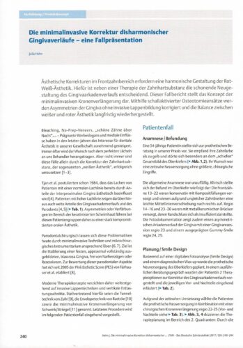 FB | Die minimalinvasive Korrektur disharmonischer Gingivaverläufe