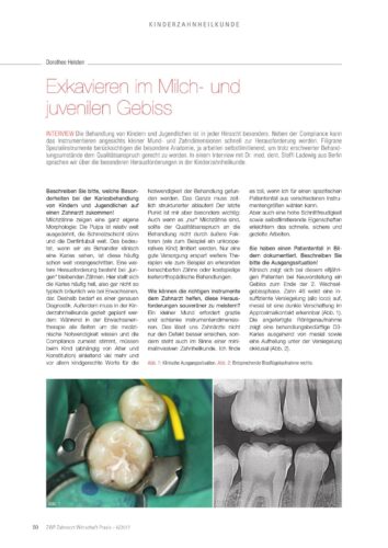 FB | Exkavieren im Milch- und juvenilen Gebiss