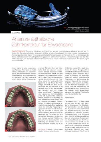 FB | Anteriore ästhetische Zahnkorrektur für Erwachsene