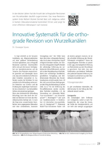 FB | Innovative Systematik für die orthograde Revision von Wurzelkanälen