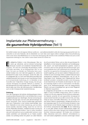 FB | Implantate zur Pfeilervermehrung - die gaumenfreie Hybridprothese (Teil 1)