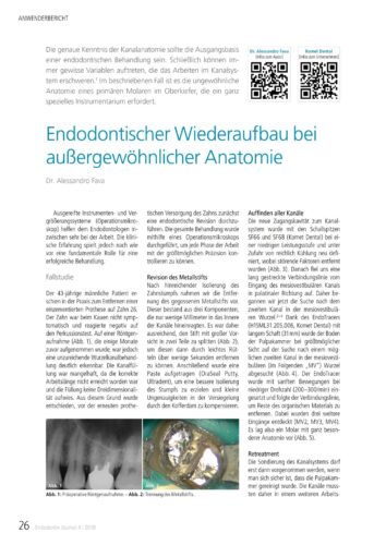 FB | Endodontischer Wiederaufbau bei außergewöhnlicher Anatomie