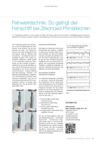 FB | Feinwerktechnik: So gelingt der Feinschliff bei Zirkonoxid-Primärkronen