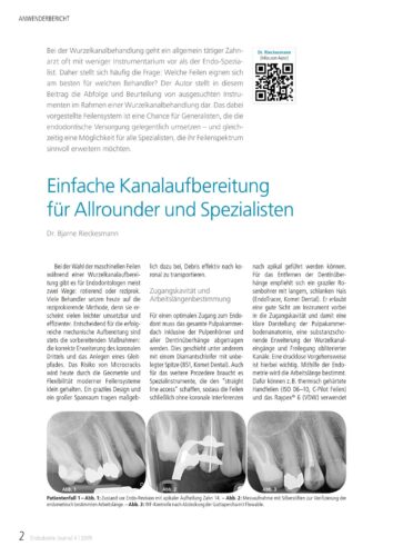 FB | Einfache Kanalaufbereitung für Allrounder und Spezialisten