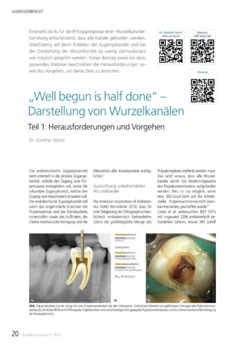 FB | „Well begun is half done“ – Darstellung von Wurzelkanälen