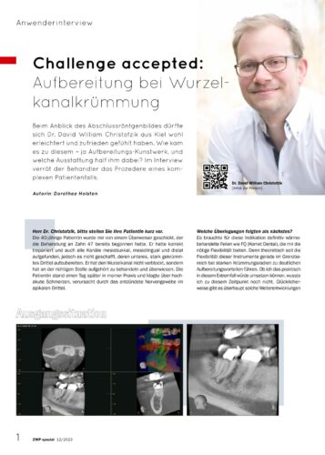 FB | Challenge accepted: Aufbereitung bei Wurzelkanalkrümmung