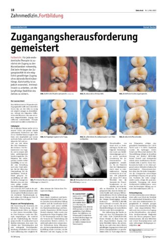 FB | Zugangsherausforderung gemeistert