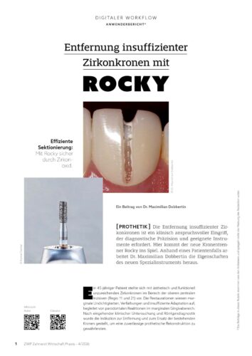 FB | Entfernung insuffizienter Zirkonkronen mit Rocky