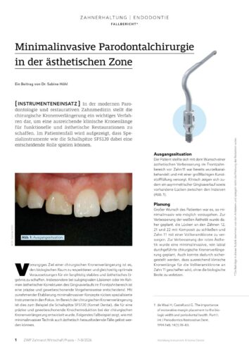 FB | Minimalinvasive Parodontalchirurgie in der ästhetischen Zone