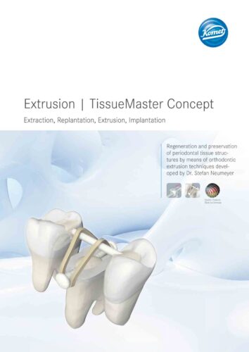 Brochure | TMC Extrusion