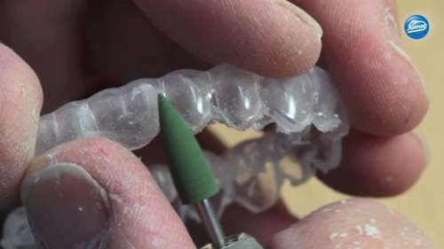 Vídeo | Modelado de los bordes de una ferula oclusal blanda