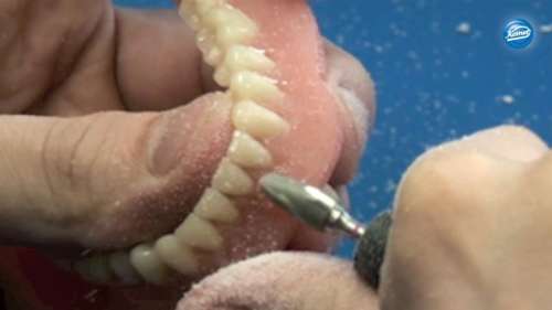 Video | Trimming and polishing of a prothesis completely made of acrylics