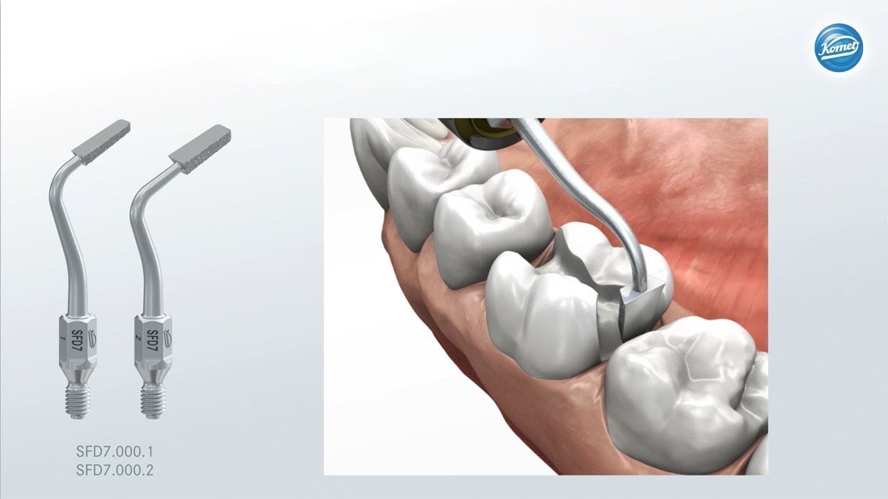 Vidéo Endo Rescue Animation › Komet Dental