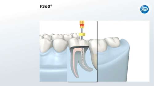 Video | F360® Animation