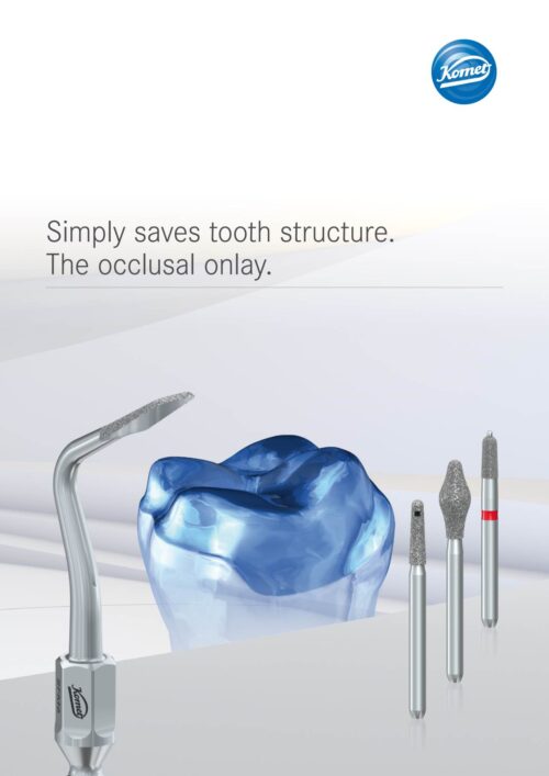 Brochure | occlusal onlays „TableTop”
