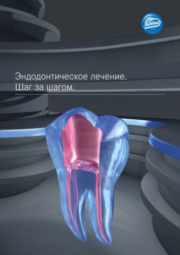 брошюра | эндодонтия шаг за шагом.