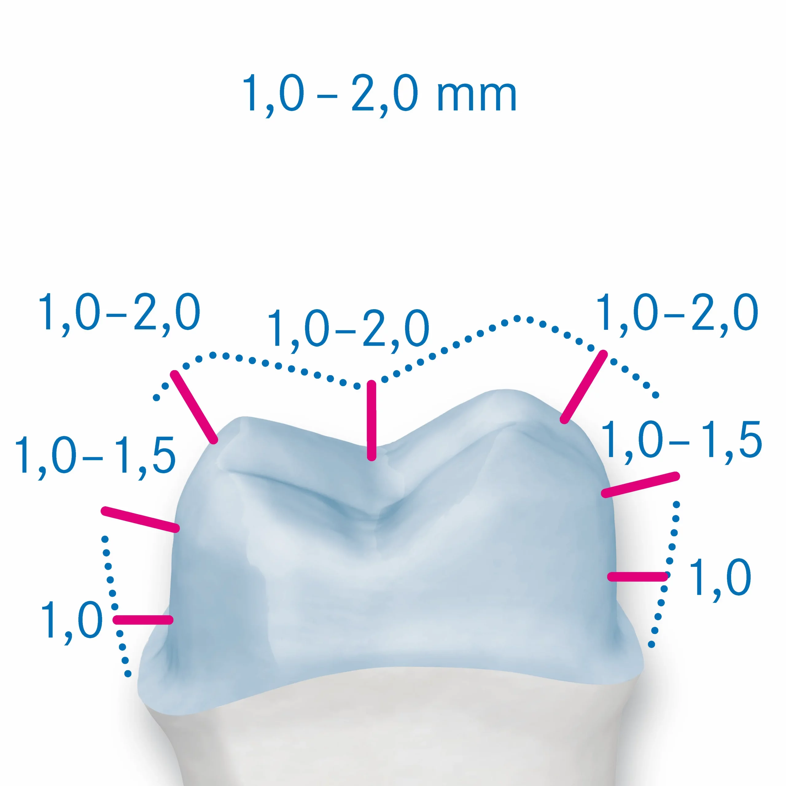 Most important rules to be observed during preparations for all cermaic crowns