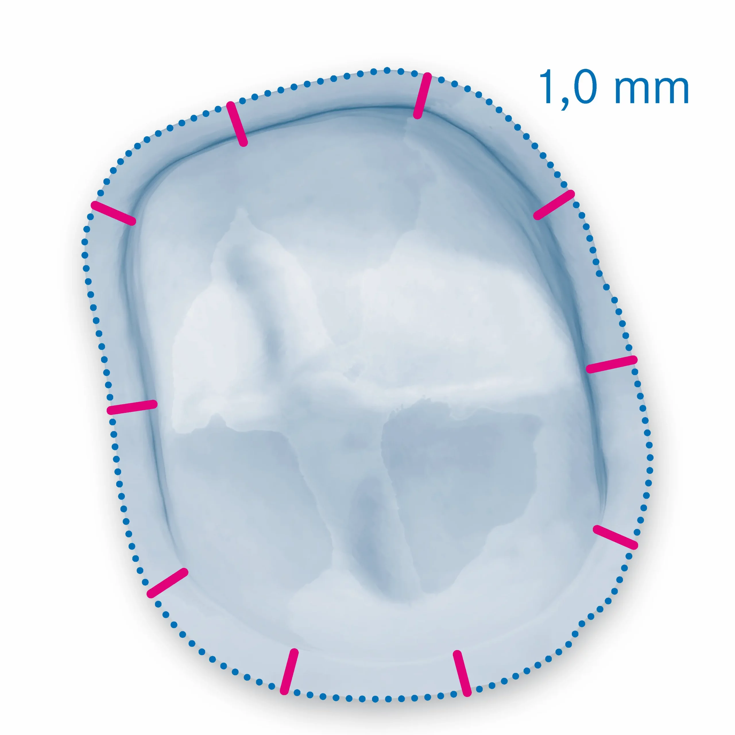 Most important rules to be observed during preparations for all cermaic crowns