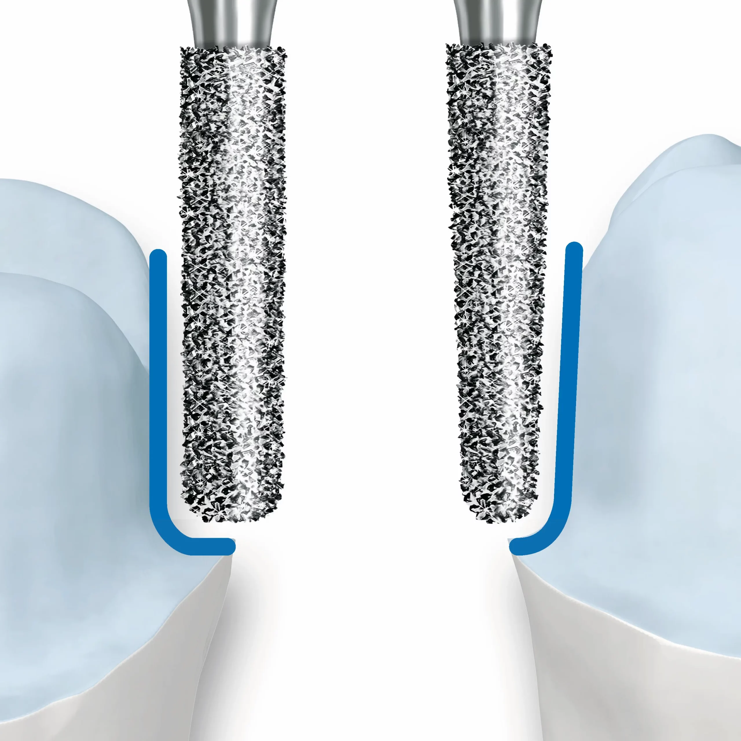 Most important rules to be observed during preparations for all cermaic crowns