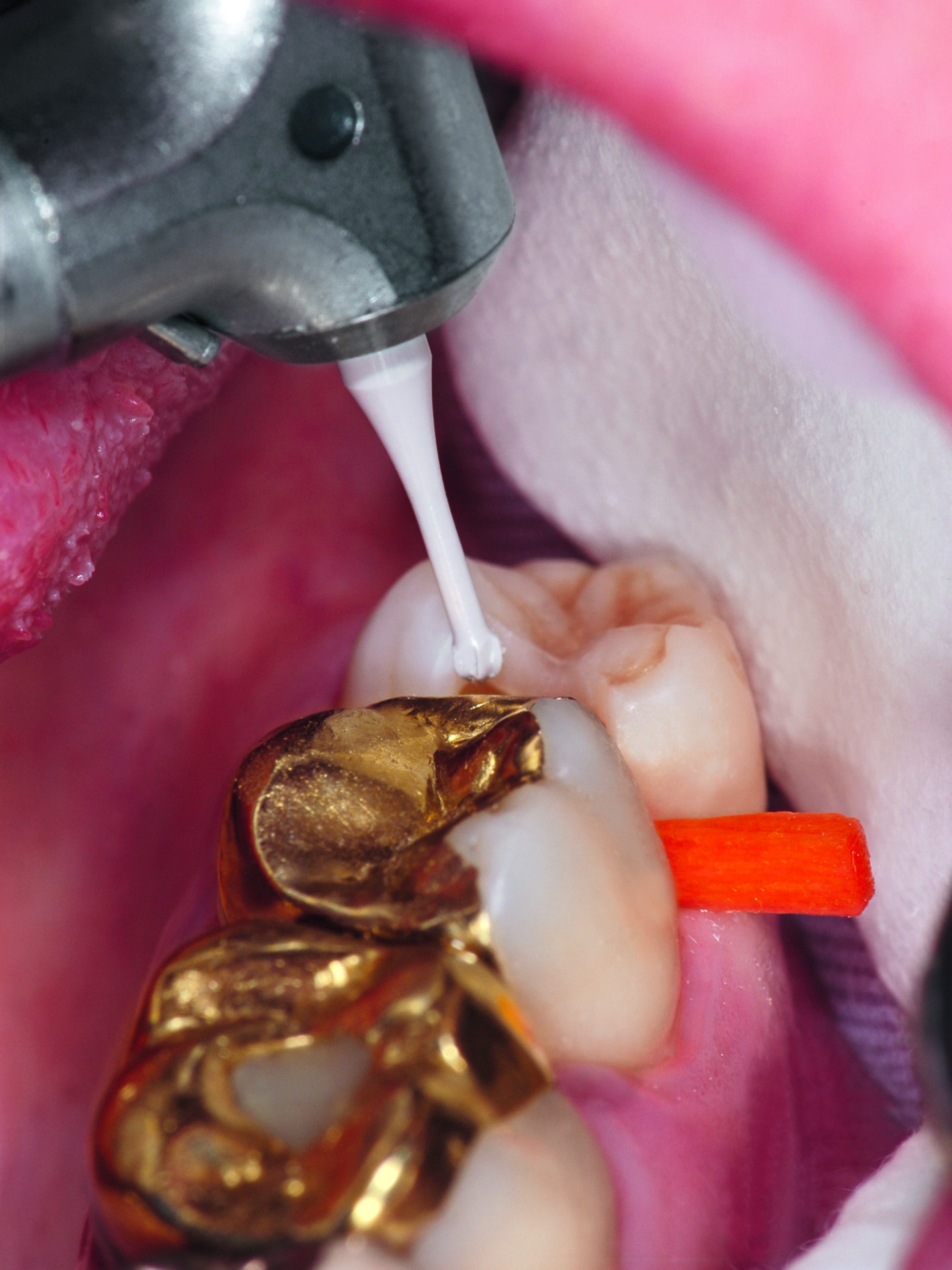 CAVI_110114_02_K1SM_701 (1)