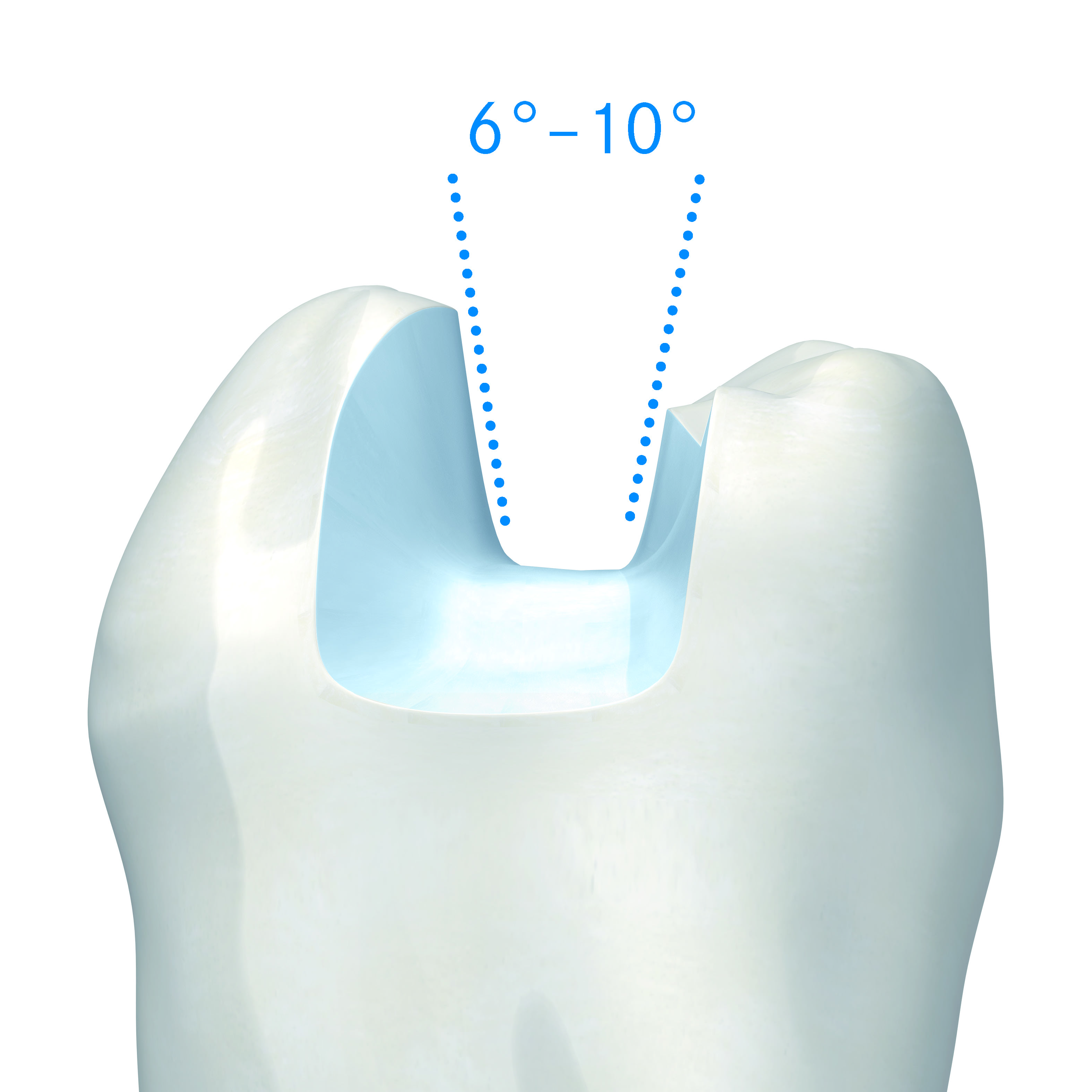 All-ceramic restaurations › Komet Dental