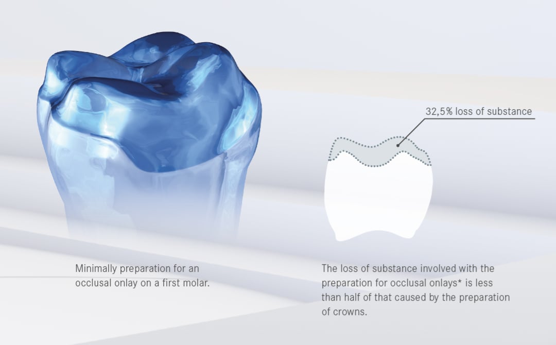 All-ceramic restaurations › Komet Dental