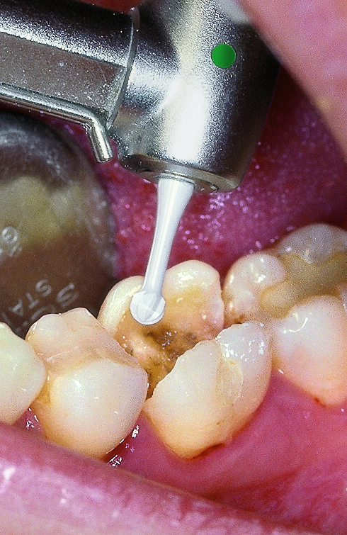 ZAAF_120404_K1SM_anw_01_701