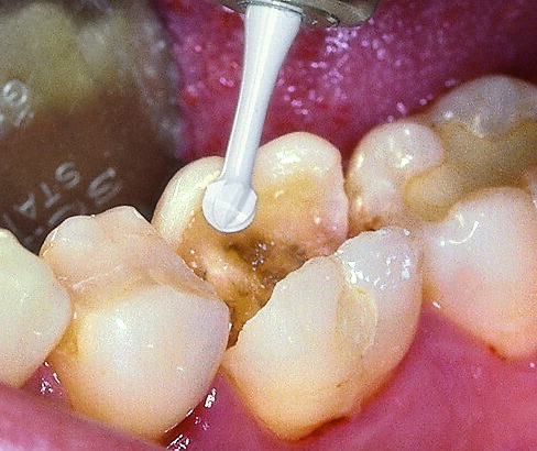 ZAAF_120404_K1SM_anw_01_701