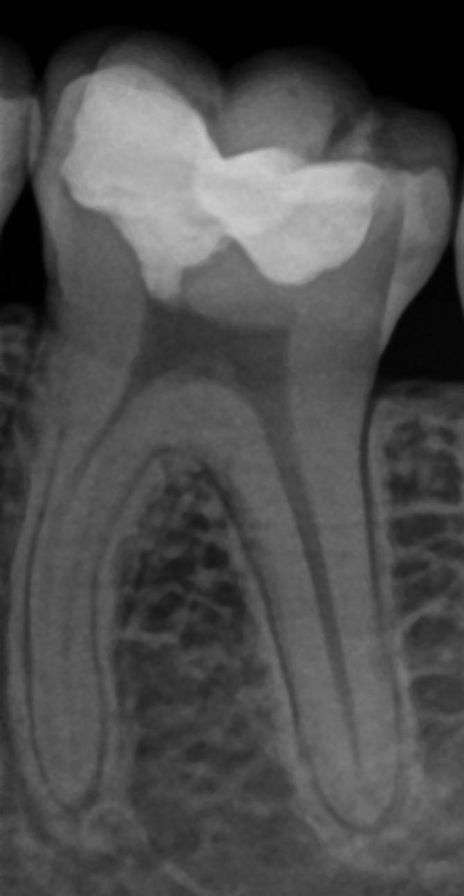 x-ray305#36 14.10.2024 Img#4 x-ray305#36 14.10.2024 Img#4